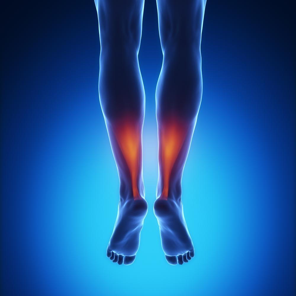 Achilles Tendon Pain: Causes, Symptoms and Treatment