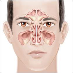 Symptoms of fungal store sinus infection