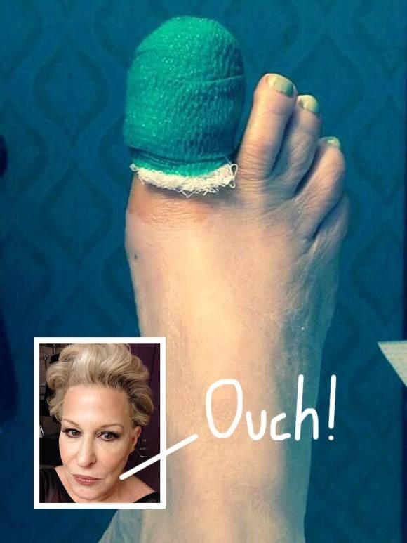 Bette Midler suffered a nasty toe injury during her stay in Texas!