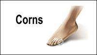 corns.png