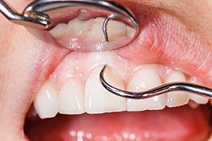 periodontal  dentistry