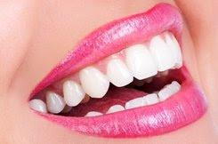 teeth whitening before and after example