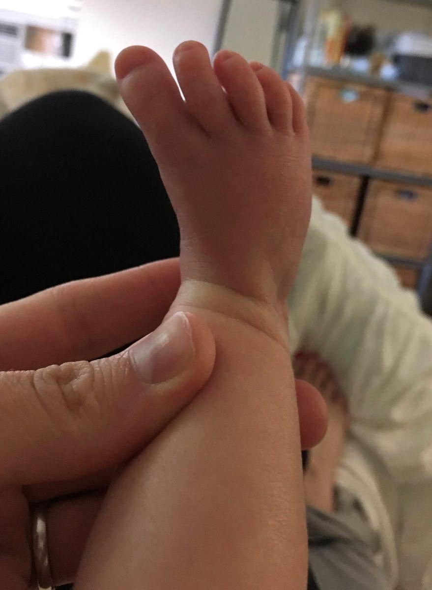 Baby's Foot: Is this Normal?
